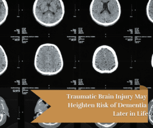 results of a ct scan for the brain